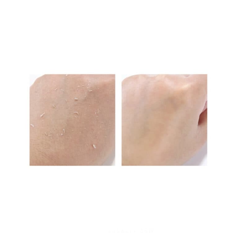 Пилинг-скатка с салициловой кислотой Pyunkang yul