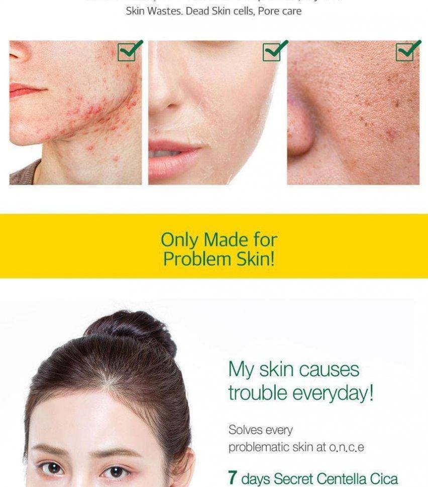 Сыворотка с AHA/BHA/PHA кислотами и центеллой азиатской May Island