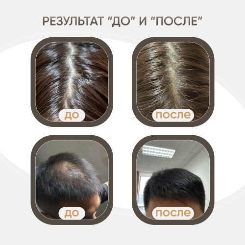 Эссенция для роста волос Elimere Эссенция для роста волос Elimere