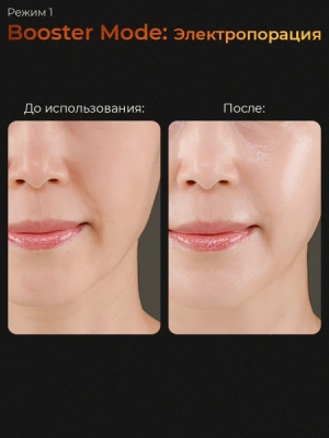 Микротоковый аппарат для лица 6-в-1 AGE-R Booster Pro Medicube