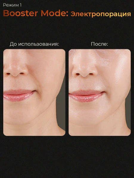 Микротоковый аппарат для лица 6-в-1 AGE-R Booster Pro Medicube Микротоковый аппарат для лица 6-в-1 AGE-R Booster Pro Medicube