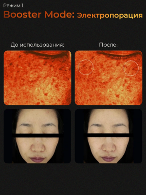 Микротоковый аппарат для лица 6-в-1 AGE-R Booster Pro Medicube
