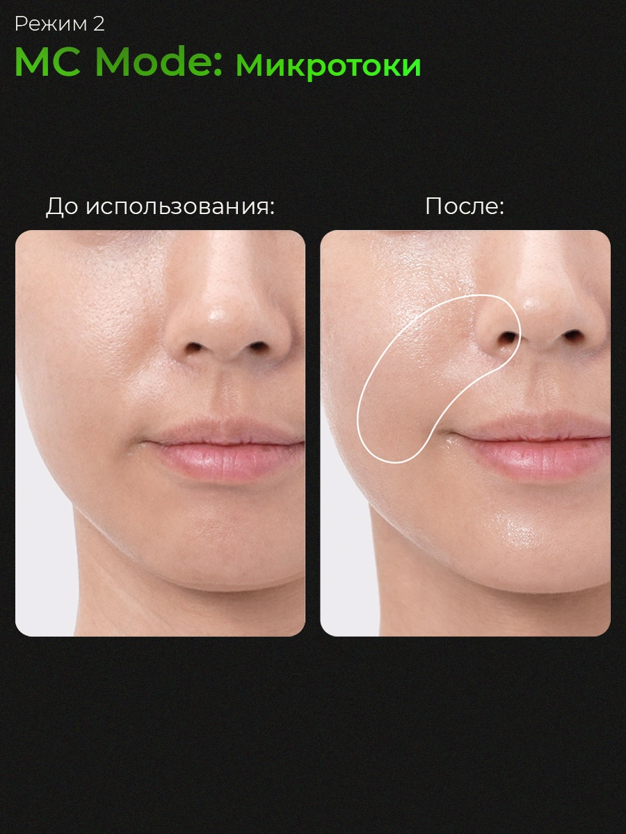 Микротоковый аппарат для лица 6-в-1 AGE-R Booster Pro Medicube Микротоковый аппарат для лица 6-в-1 AGE-R Booster Pro Medicube