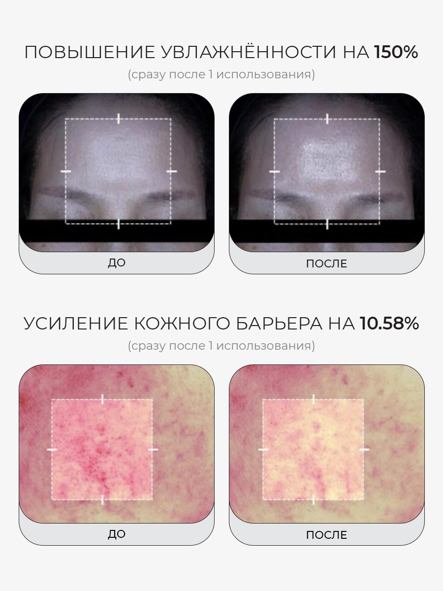 Сыворотка с микроиглами ПДРН и экзосомами Medicube