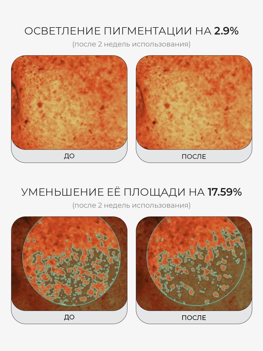 Сыворотка с микроиглами ПДРН и экзосомами Medicube